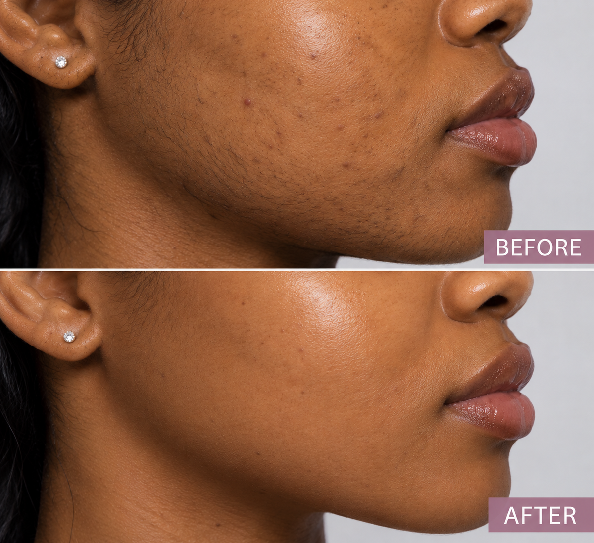 VERAGLOYZY Cyperus Rotundus Skin Serum.